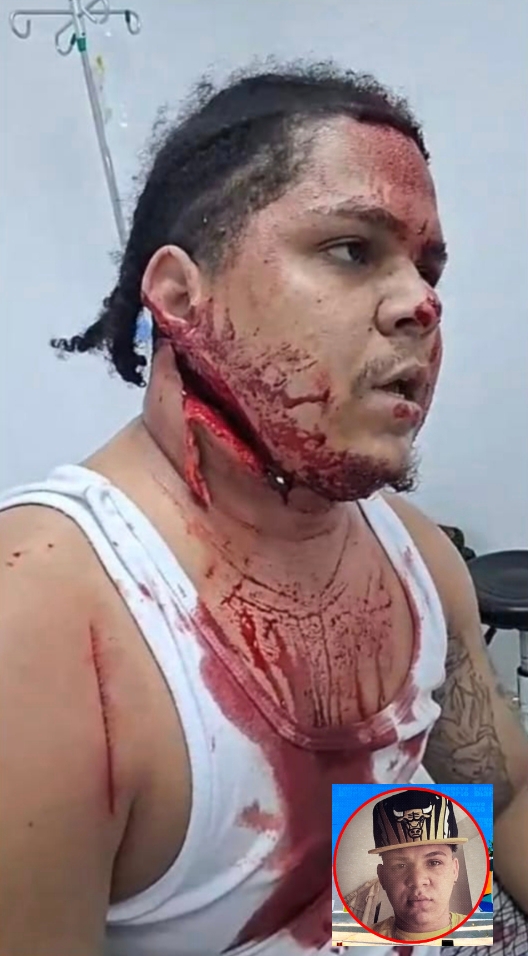 Ranfi Díaz mutilado por el gobierno